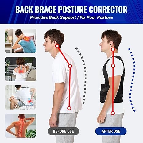 X-Shape Posture Corrector